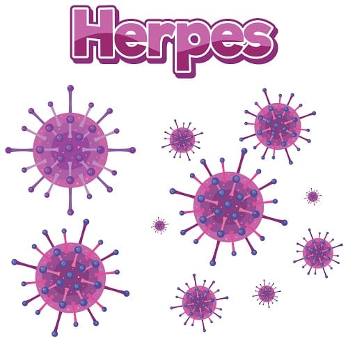 herpes zoster rak